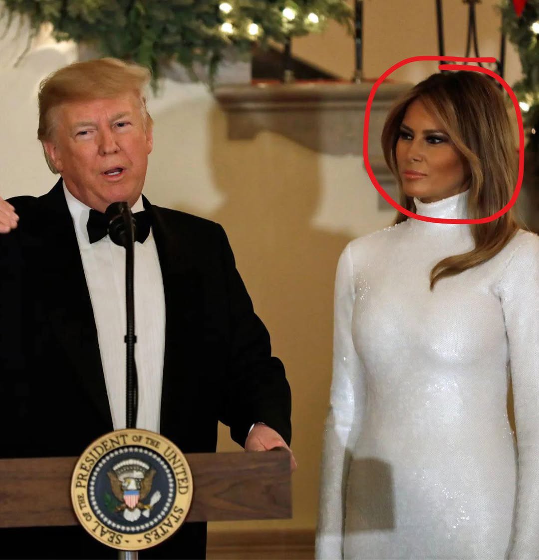 At MaraLago, Melania Trump Sparks Cosmetic Surgery Rumors NI